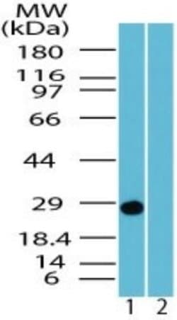 Invitrogen PGP9.5 Polyclonal Antibody 100 &mu;g | Buy Online | Invitrogen&trade; | Fisher Scientific