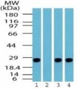 Invitrogen PGP9.5 Polyclonal Antibody 100 &mu;g; Unconjugated:Antibodies,