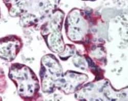 Invitrogen SSTR5 Polyclonal Antibody 100 &mu;g | Buy Online | Invitrogen&trade; | Fisher Scientific