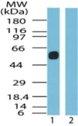 Invitrogen SSTR5 Polyclonal Antibody 100 &mu;g | Buy Online | Invitrogen&trade; | Fisher Scientific