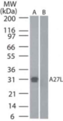 Invitrogen Smallpox Virus A27L Polyclonal Antibody 100 &mu;g; Unconjugated:Antibodies,