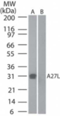 Invitrogen Smallpox Virus A27L Polyclonal Antibody 100 &mu;g | Buy Online | Invitrogen&trade; | Fisher Scientific