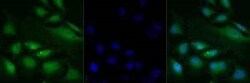 Invitrogen SMAD3 Polyclonal Antibody 100 &mu;g | Buy Online | Invitrogen&trade; | Fisher Scientific