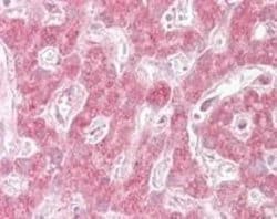 Invitrogen TNPO1 Polyclonal Antibody 100 &mu;g; Unconjugated:Antibodies,