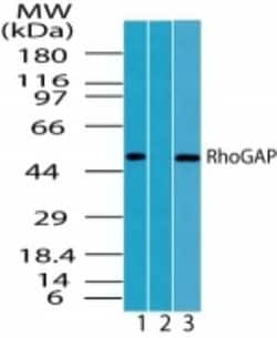 Invitrogen RhoGAP Polyclonal Antibody 100 &mu;g | Buy Online | Invitrogen&trade; | Fisher Scientific
