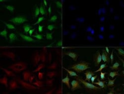 Invitrogen RIP3 Polyclonal Antibody 100 &mu;g; Unconjugated:Antibodies,