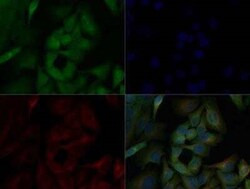 Invitrogen NFkB p65 Polyclonal Antibody 100 &mu;g | Buy Online | Invitrogen&trade; | Fisher Scientific