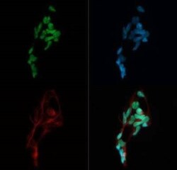 Invitrogen MTA2 Polyclonal Antibody 100 &mu;g; Unconjugated:Antibodies,