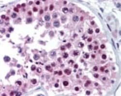 Invitrogen MTA2 Polyclonal Antibody 100 &mu;g; Unconjugated:Antibodies,