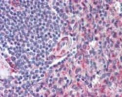 Invitrogen CD97 Polyclonal Antibody 100 &mu;g; Unconjugated:Antibodies,