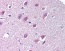 Invitrogen Importin 9 Polyclonal Antibody 100 &mu;g; Unconjugated:Antibodies,