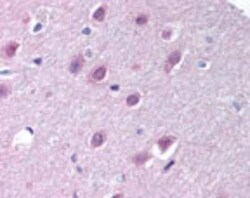 Invitrogen Importin 9 Polyclonal Antibody 100 &mu;g | Buy Online | Invitrogen&trade; | Fisher Scientific