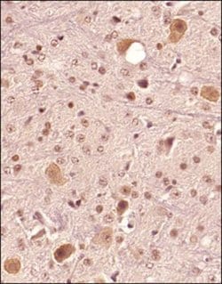 Invitrogen FAM3C Polyclonal Antibody 100 &mu;g | Buy Online | Invitrogen&trade; | Fisher Scientific