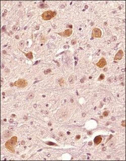 Invitrogen FAM3C Polyclonal Antibody 100 &mu;g | Buy Online | Invitrogen&trade; | Fisher Scientific