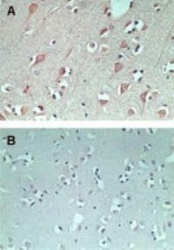 Invitrogen FAM3C Polyclonal Antibody 100 &mu;g | Buy Online | Invitrogen&trade; | Fisher Scientific