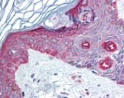 Invitrogen FAM3C Polyclonal Antibody 100 &mu;g | Buy Online | Invitrogen&trade; | Fisher Scientific