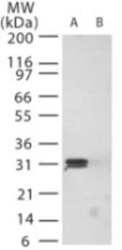 Invitrogen PrP Polyclonal Antibody 100 &mu;g | Buy Online | Invitrogen&trade; | Fisher Scientific