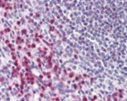 Invitrogen BCLAF1 Polyclonal Antibody 100 &mu;g; Unconjugated:Antibodies,