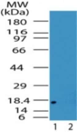 Invitrogen Acid Phosphatase 1 Polyclonal Antibody 100 &mu;g; Unconjugated:Antibodies,