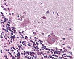 Invitrogen CDR2 Polyclonal Antibody 100 &mu;L; Unconjugated:Antibodies,