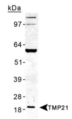 Invitrogen TMP21 Polyclonal Antibody 100 &mu;L; Unconjugated:Antibodies,