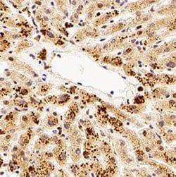 Invitrogen TMP21 Polyclonal Antibody 100 &mu;L; Unconjugated:Antibodies,
