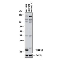 Invitrogen TMP21 Polyclonal Antibody 100 &mu;L | Buy Online | Invitrogen&trade; | Fisher Scientific