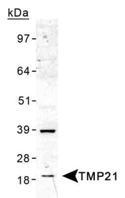 Invitrogen TMP21 Polyclonal Antibody 100 &mu;L | Buy Online | Invitrogen&trade; | Fisher Scientific