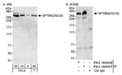 Invitrogen Spectrin beta-3 Polyclonal Antibody 100 &mu;L; Unconjugated:Antibodies,