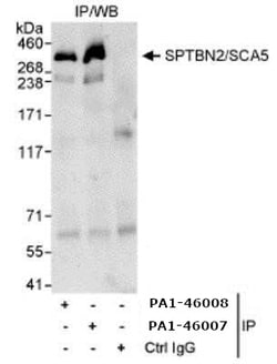 Invitrogen Spectrin beta-3 Polyclonal Antibody 100 &mu;g; Unconjugated:Antibodies,