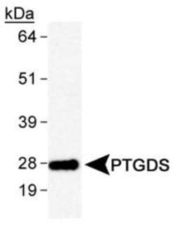 Invitrogen PTGDS Polyclonal Antibody 100 &mu;L; Unconjugated:Antibodies,