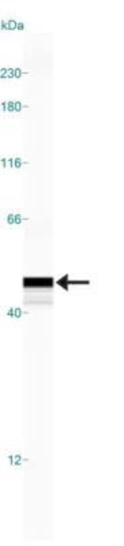 Invitrogen PTGDS Polyclonal Antibody 100 &mu;L; Unconjugated:Antibodies,