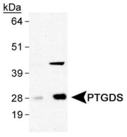Invitrogen PTGDS Polyclonal Antibody 100 &mu;L; Unconjugated:Antibodies,