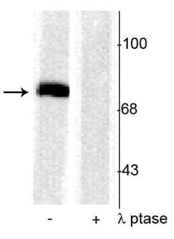 Invitrogen Phospho-Synapsin 1 (Ser603) Polyclonal Antibody 100 &mu;L | Buy Online | Invitrogen&trade; | Fisher Scientific