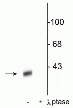 Invitrogen Phospho-DARPP-32 (Thr34) Polyclonal Antibody 100 &mu;L; Unconjugated:Antibodies,