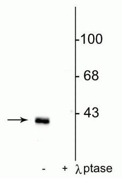Invitrogen Phospho-DARPP-32 (Thr75) Polyclonal Antibody 100 &mu;L; Unconjugated:Antibodies,