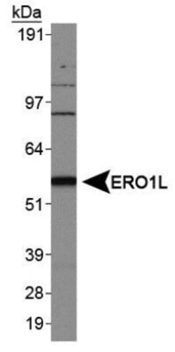 Invitrogen ERO1L Polyclonal Antibody 100 μL; Unconjugated:Antibodies,