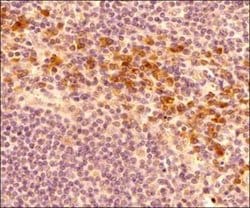 Invitrogen HRD1 Polyclonal Antibody 100 &mu;L; Unconjugated:Antibodies,