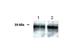 Invitrogen UBIAD1 Polyclonal Antibody 100 &mu;L; Unconjugated:Antibodies,