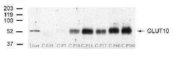 Invitrogen GLUT10 Polyclonal Antibody 100 &mu;g; Unconjugated:Antibodies,
