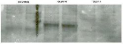 Invitrogen GLUT10 Polyclonal Antibody 100 &mu;g; Unconjugated:Antibodies,