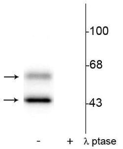 Invitrogen Phospho-CaMKII alpha/beta (Thr286) Polyclonal Antibody 100 &mu;L;