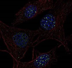 Invitrogen 53BP1 Polyclonal Antibody 100 &mu;L | Buy Online | Invitrogen&trade; | Fisher Scientific