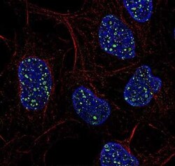 Invitrogen 53BP1 Polyclonal Antibody 100 &mu;L | Buy Online | Invitrogen&trade; | Fisher Scientific