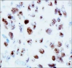 Invitrogen 53BP1 Polyclonal Antibody 100 &mu;L; Unconjugated:Antibodies,