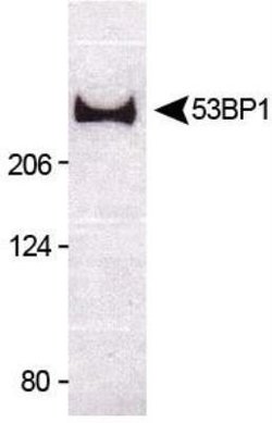 Invitrogen 53BP1 Polyclonal Antibody 100 &mu;L; Unconjugated:Antibodies,