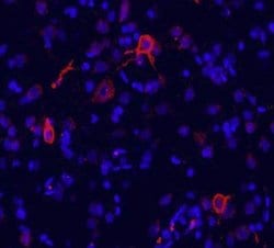 Invitrogen mGluR1 Polyclonal Antibody 100 &mu;g | Buy Online | Invitrogen&trade; | Fisher Scientific