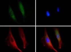 Invitrogen DISC1 Polyclonal Antibody 100 &mu;L | Buy Online | Invitrogen&trade; | Fisher Scientific