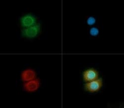 Invitrogen TOM70 Polyclonal Antibody 100 &mu;L; Unconjugated:Antibodies,