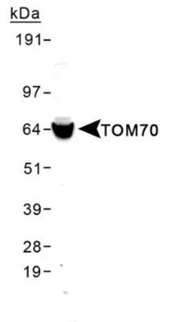 Invitrogen TOM70 Polyclonal Antibody 100 &mu;L; Unconjugated:Antibodies,